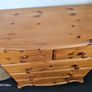 chest Image 2