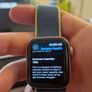 Apple Watch SE 40mm Gold - Model A2351 - Huge Bundle with 11 Straps - Original Box Image 8