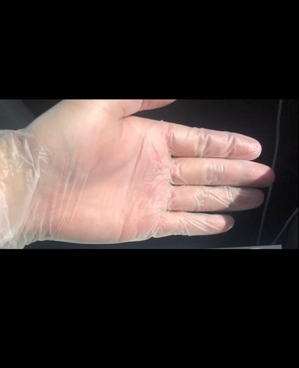vinyl gloves