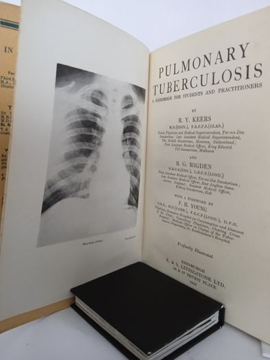 Pulmonary Tuberculosis: A Handbook For Students and Practitioners by R. Y. Keers and B. G. Rigden (HQ555)