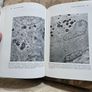 Beckers- Shaffer's Diagnosis And Therapy Of The Glaucomas. By Allan E. Kolker & John Hetherington,jr. Large Volume Hardback In Good Condition. See Photos For Same. Image 8