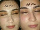 Dermaplaning Image 4