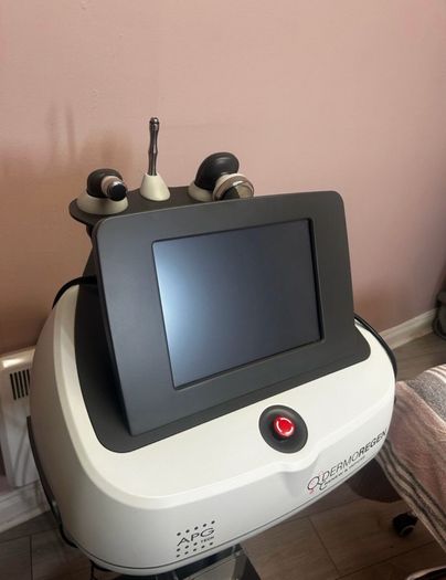 Microdermabrasion