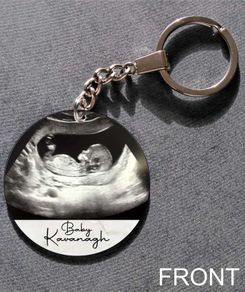 Baby Scan - Personalised Keychain