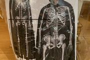 Hooded Skeleton Costume
