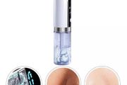 Blackhead remover