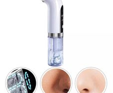 Blackhead remover