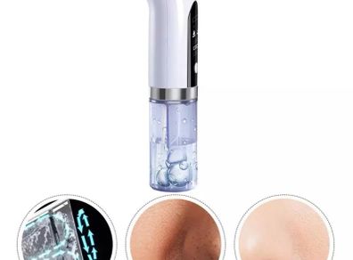 Blackhead remover