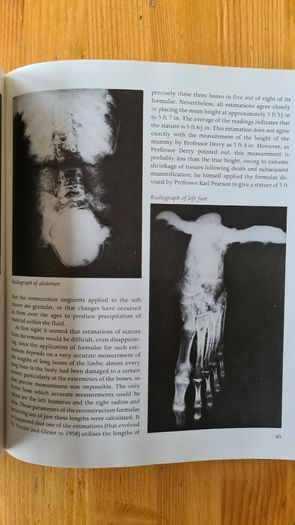 Chronicle. Essays From Ten Years Of Television Archaeology Bbc. TV. FIRST EDITION 1978.Hardback With Dustjacket In Very Good Condition. Large Volume Book.