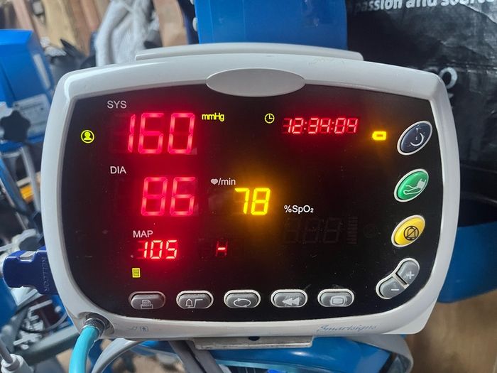 blood pressure monitor