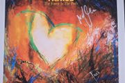 Signed snow patrol