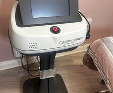 Microdermabrasion