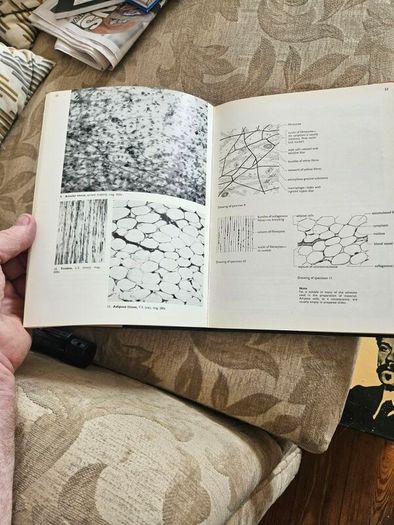 An Atlas Of Histology. By W.h. Freeman And Brian Bracegirdle. Second Edition Large Volume Hardback With Dustjacket.  Book In Good Condition.  Dustjacket Tatty.  See Photos For Same.