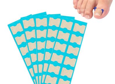 Brand New Toenail Patch, Ingrown Toenail, Toenail Correction,