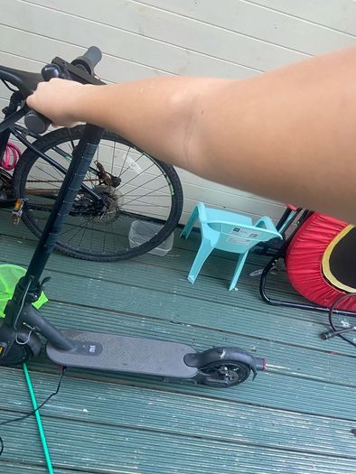 electric scooter