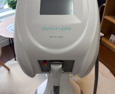 laser hair removal