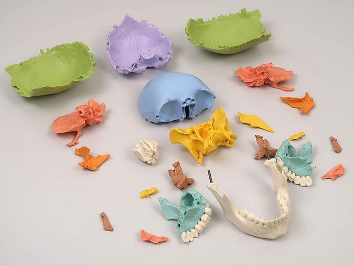 3B Scientific A291 Human Skull 22 part Model