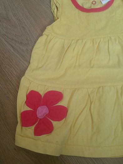 baby dress