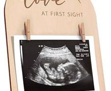 Coming baby photo frame