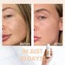 Kanzen Pore Purifier 125ml Image 4