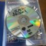 The Complete Blackadder - All Four Series Image 9