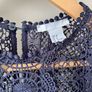 H&M lace dress (10) Image 5