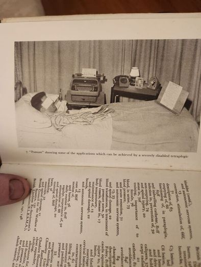 Understanding Paraplegia. By J.j. Walsh. First Edition. 1964. Hardback In Good Condition.