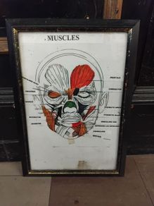 Medical Chart Framed