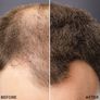 Toppik Coloured Hair Thickener Image 2