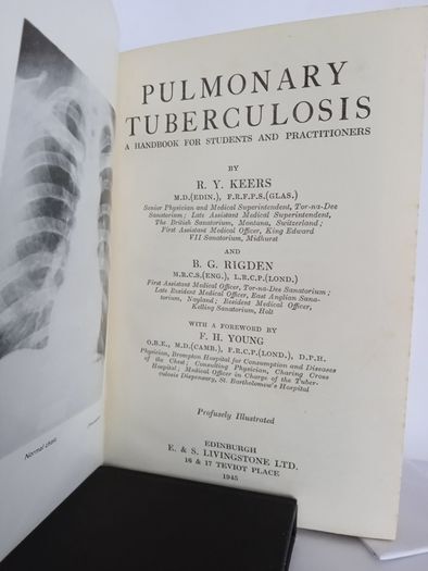 Pulmonary Tuberculosis: A Handbook For Students and Practitioners by R. Y. Keers and B. G. Rigden (HQ555)
