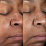 PMD Clean Mini Sonic Skin Cleansing Brush Image 5