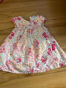 baby dress