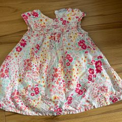 baby dress