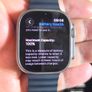 Apple Watch Ultra Image 6