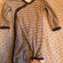 14 Footless baby grows. Image 2