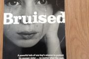 Bruised by Siobhan Parkinson