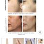 Sensse Microderma Duo  Designed for microdermabrasion and dermaplaning, the multi-functioning beauty tool works to refine and soften the surface of the skin. BNIB GENUINE Image 4
