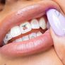 Hismile Temporary Tooth Tattoo RRP 7 euro Image 2