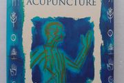 Acupuncture