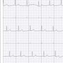 Kardia Mobile ECG Image 4