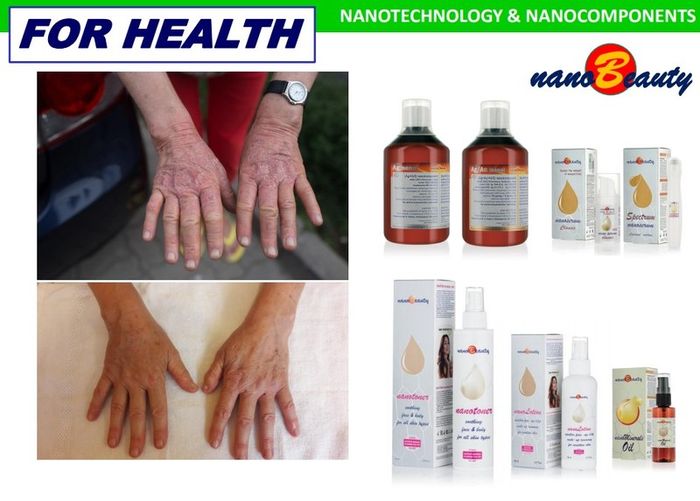 NanoBeauty NANOSERUM total body NEW NANO-TECHNOLOGY All-in-One with gold, silver, silica and zinc nanoparticlesANTI-AGE LIFT-ACTIVE intensively rejuvenating serum that supports skin's biological rejuvenation with additional active anti-wrinkle effect Inno