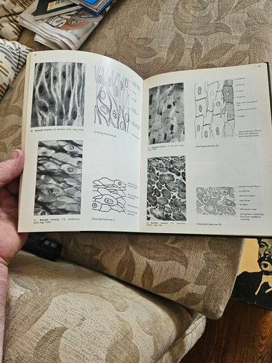 An Atlas Of Histology. By W.h. Freeman And Brian Bracegirdle. Second Edition Large Volume Hardback With Dustjacket.  Book In Good Condition.  Dustjacket Tatty.  See Photos For Same.