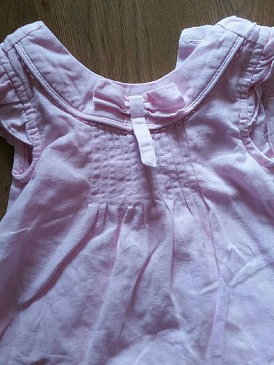 baby dress