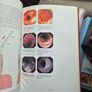 Gastrointestinal Endoscopy Image 7