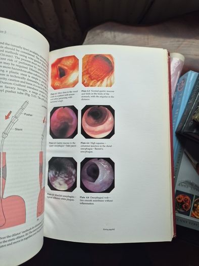 Gastrointestinal Endoscopy