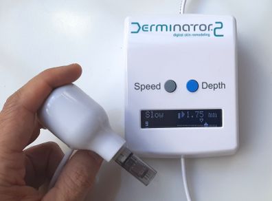 Derminator 2 - automated microneedling device