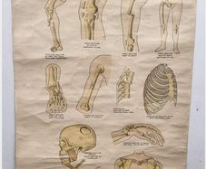 1942 First Aid fracture chart