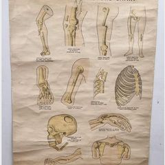 1942 First Aid fracture chart
