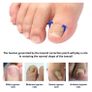 Brand New Toenail Patch, Ingrown Toenail, Toenail Correction, Image 3