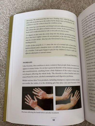 Aloe Vera: The Medicine Plant Book